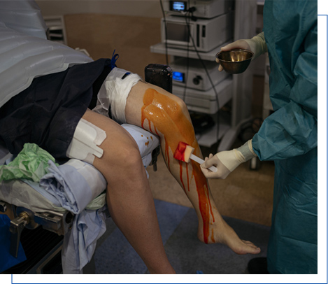 Knee replacement surgery