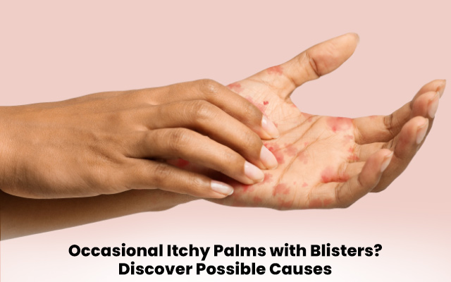 Occasional Itchy Palms with Blisters? Discover Possible Causes