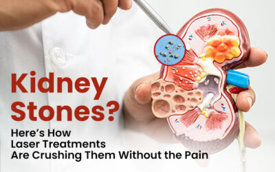 Kidney Stones? Here’s How Laser Treatments Are Crushing Them Without the Pain